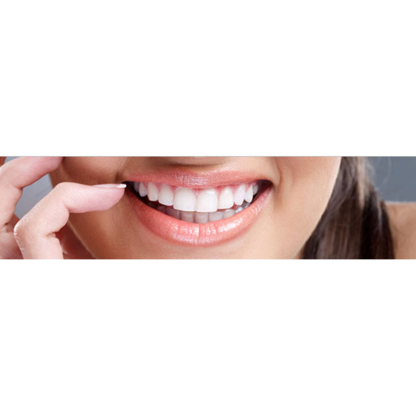 Southgate Dental Centre - Traitement de blanchiment des dents