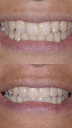 Bertie Dental Office - Dentists