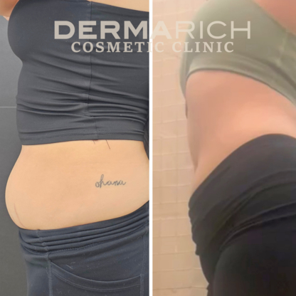 Dermarich Cosmetic Clinic - Beauty & Health Spas