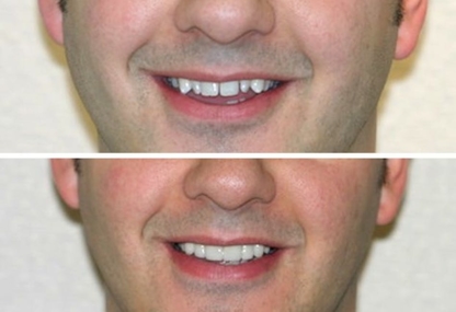 DentaCare Group: Nathaniel Podilsky, DMD - Teeth Whitening Services