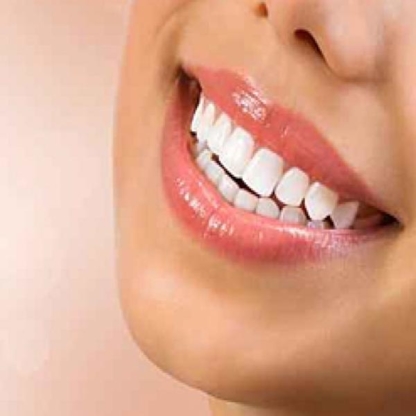 White Smile BC - Teeth Whitening Services