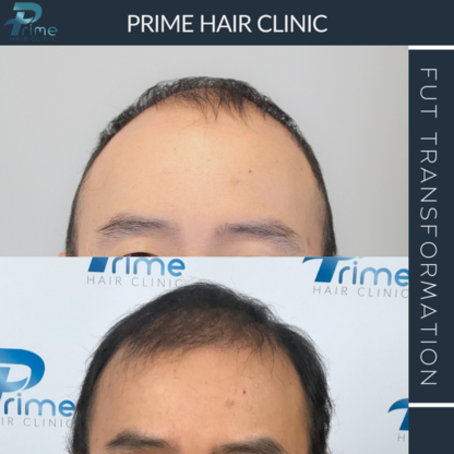 Prime Hair Clinic - Hair Goods