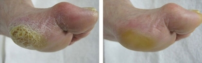 Sheila's Professional Foot Care Company - Soins des pieds
