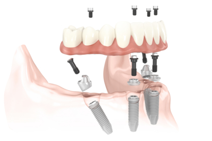 Baluke Dental Studios - Cliniques et centres dentaires