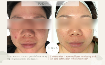 Terra Skin Clinic - Cliniques