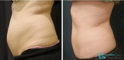 Anti-Aging Clinic Toronto - Laser Treatments & Therapy