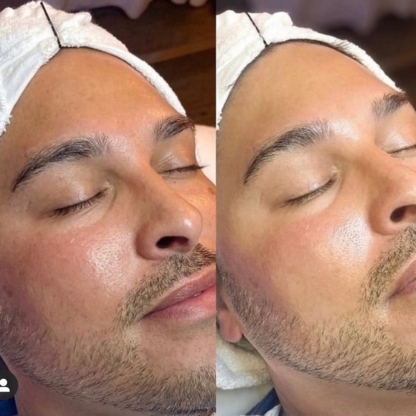 Perfecta Med Spa & Wellness Inc. - Stress Management Counseling