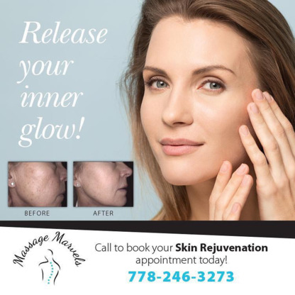 Laser Hair Removal in Langley BC ™