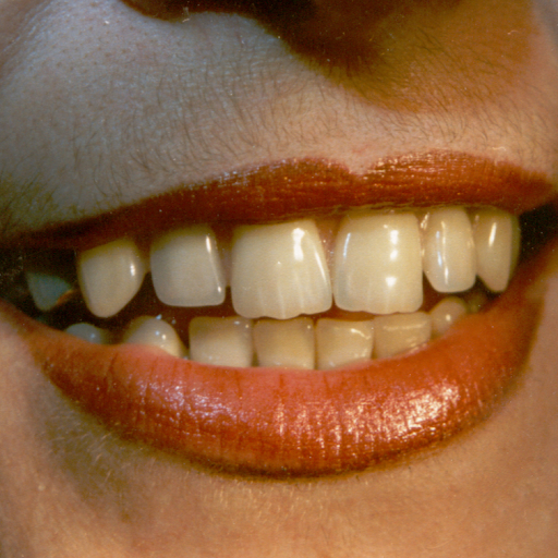 Paul Bernard denturologiste - Sainte-Foy, Cap-Rouge, Sillery, Ancienne Lorette - Denturologistes