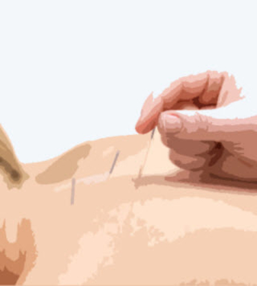 Bridge Physio - Acupuncteurs