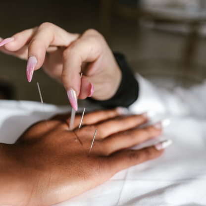 View Acupuncture For Better Health’s Toronto profile