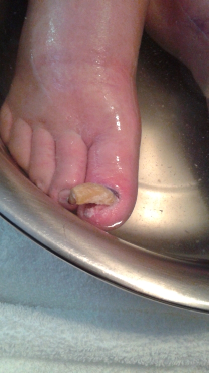 soins des pieds sherbrooke soins des pieds sherbrooke