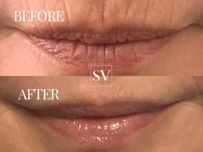 Skin Vitality Medical Clinic Ajax - Medical Clinics