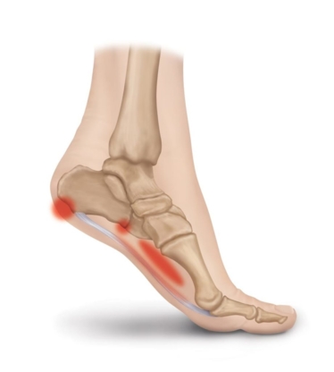 Valley East Foot Clinic and Orthotics - Appareils orthopédiques