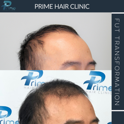 Prime Hair Clinic - Physicians & Surgeons