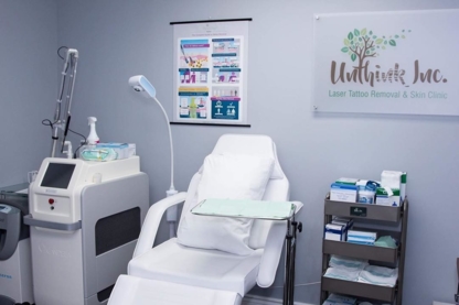 Unthink Inc. - Laser Tattoo Removal