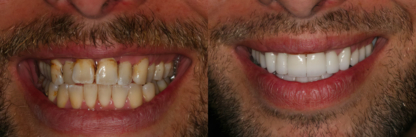 Smile Montreal - Dentistes