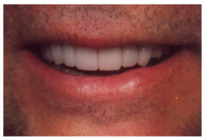Pembina Dental Centre - Teeth Whitening Services