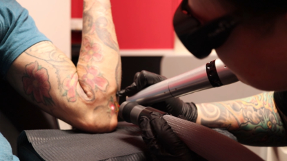 Legacy Tattoo Removal Limited