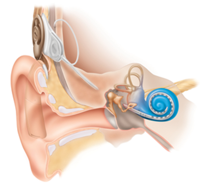 Encore Audiology - Prothèses auditives