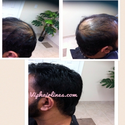 VIP Hairlines - Perruques et postiches