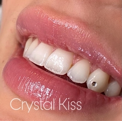 Crystal Kiss Toronto - Teeth Whitening Services