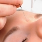 Chinese Therapy Centre - Acupuncturists