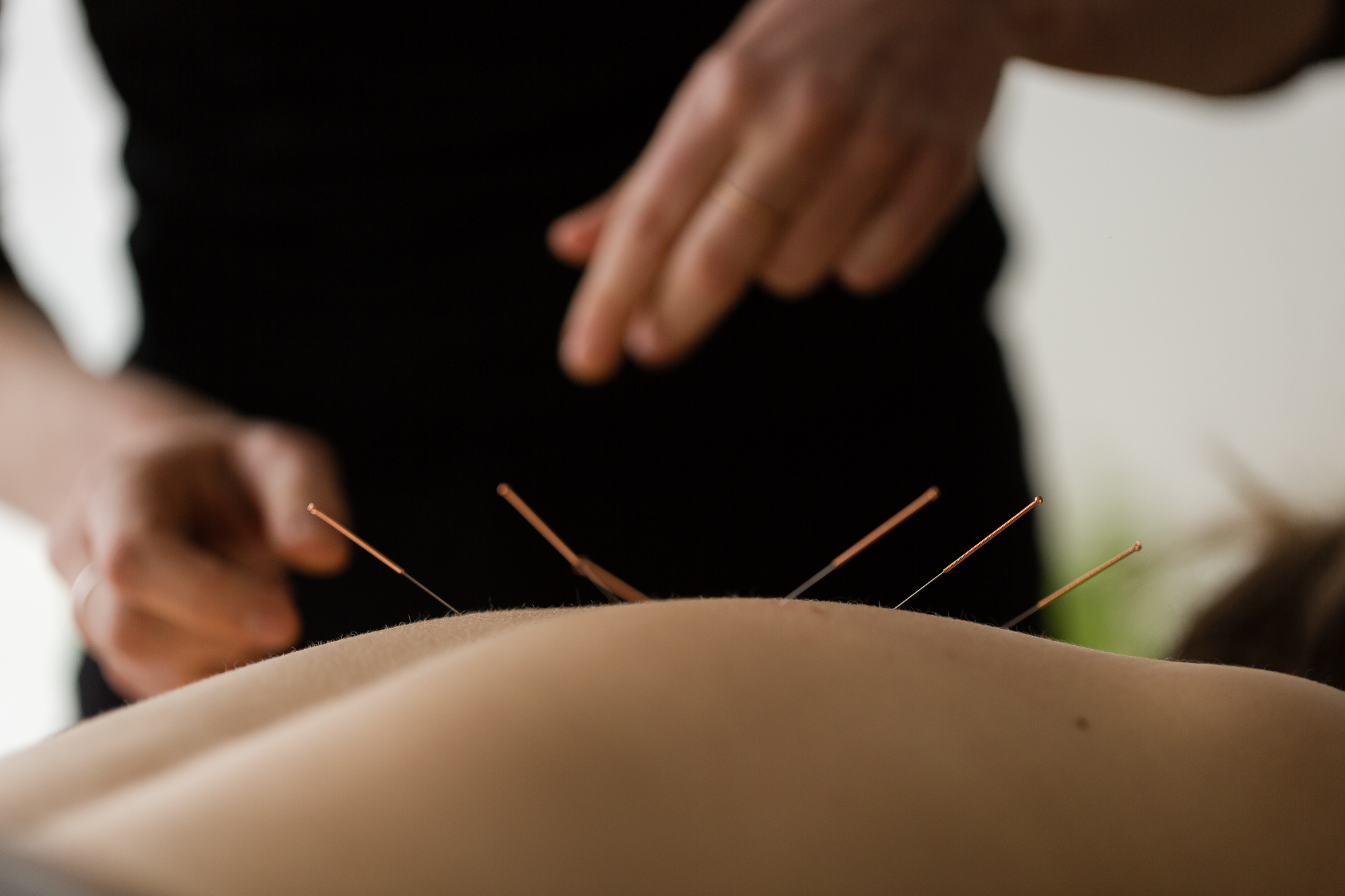 Acupuncture Laura-Anne Marcotte - Massage Therapists