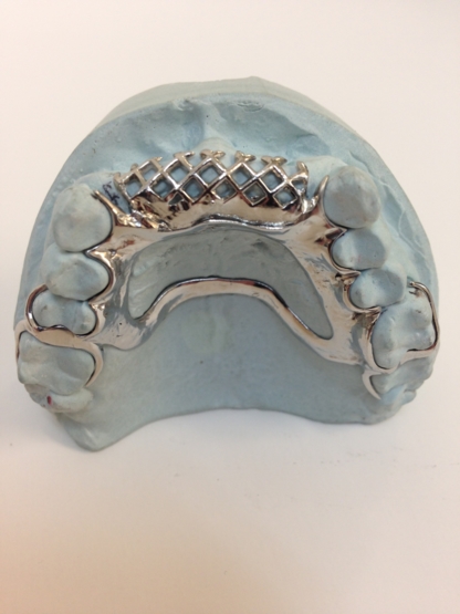 Precise Cast Frames - Techniciens dentaires
