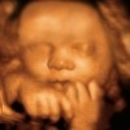 UC Baby 3D Ultrasound - Cliniques