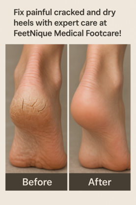 Feetnique Medical Footcare Clinic - Foot Care