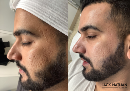 Jack Nathan Medspa - Brampton - Cliniques médicales