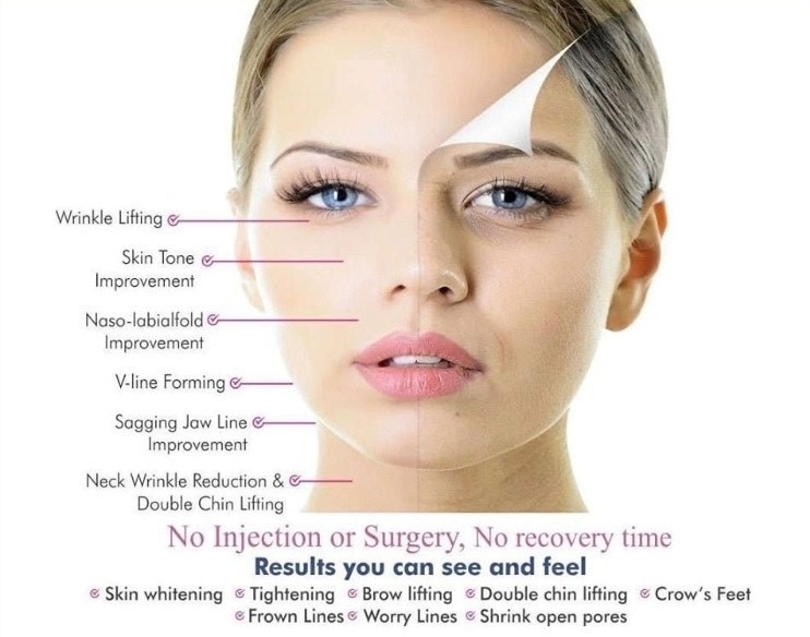 Within The Skin Medi Spa Inc. - Épilation laser
