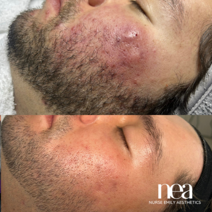 NEA: Nurse Emily Aesthetics - Spas : santé et beauté