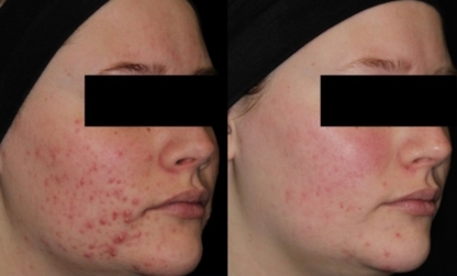 ML Aesthetic Clinic - Beauty & Health Spas