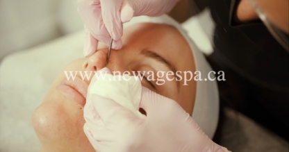 New Age Spa - Traitement de blanchiment des dents