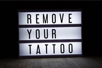 Détatouage au laser Priscillya Mongeau - Laser Tattoo Removal