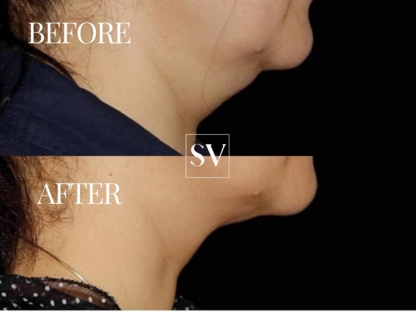 Skin Vitality Medical Clinic Milton - Produits et traitements de soins de la peau