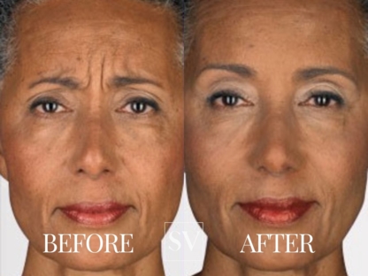Skin Vitality Medical Clinic Hamilton - Medical Clinics