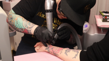 Legacy Tattoo Removal Limited - Détatouage laser