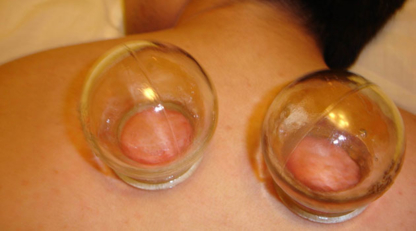Voir le profil de Dr Ivy Pang Chinese Medicine & Acupuncture Clinic - Greater Vancouver