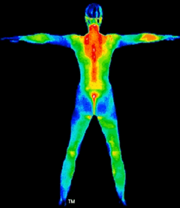 HealthSCAN Thermography - Health Information & Services