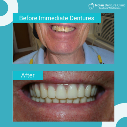 Nolan Denture Clinic - Denturologistes