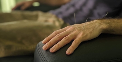 Access Acupuncture - Acupuncturists