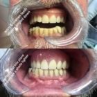Steve Kerr Denture Clinic - Denturologistes