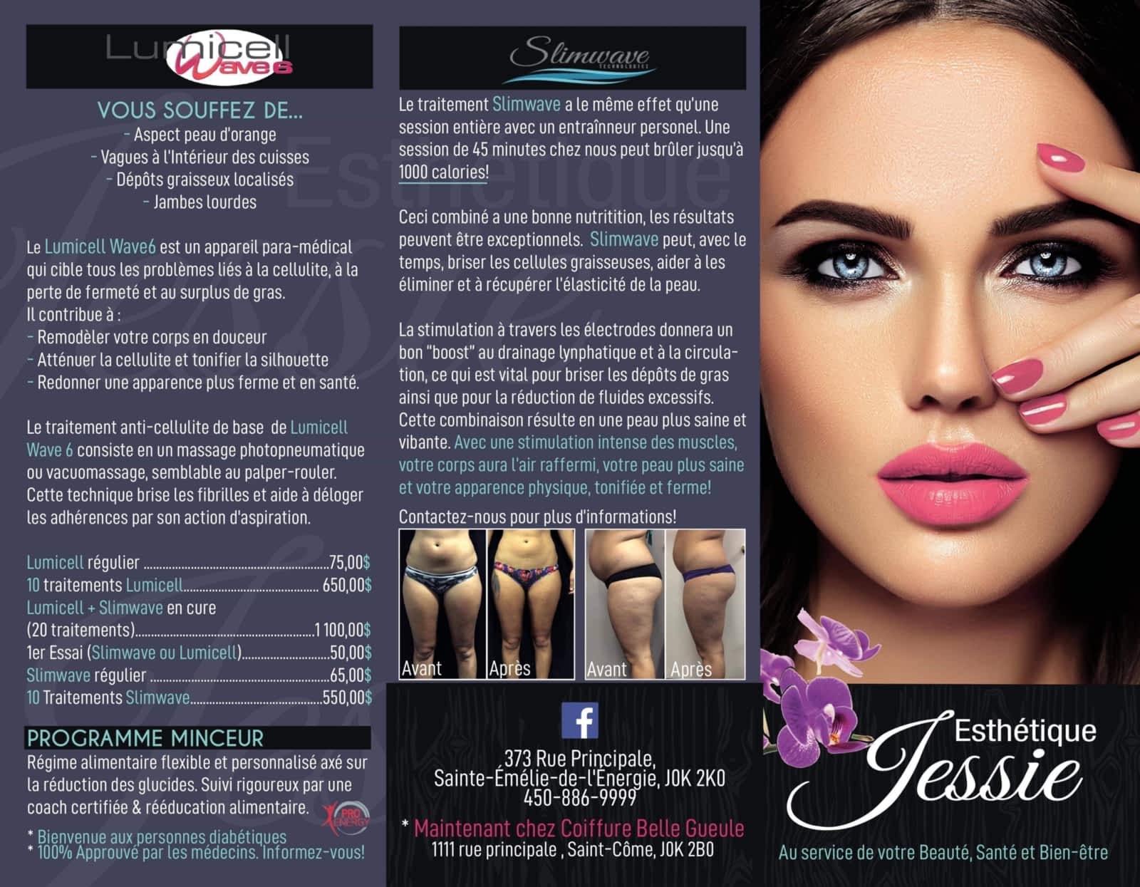 Esthetique Jessie Opening Hours 373 Principale Sainte Emelie De L Energie Qc