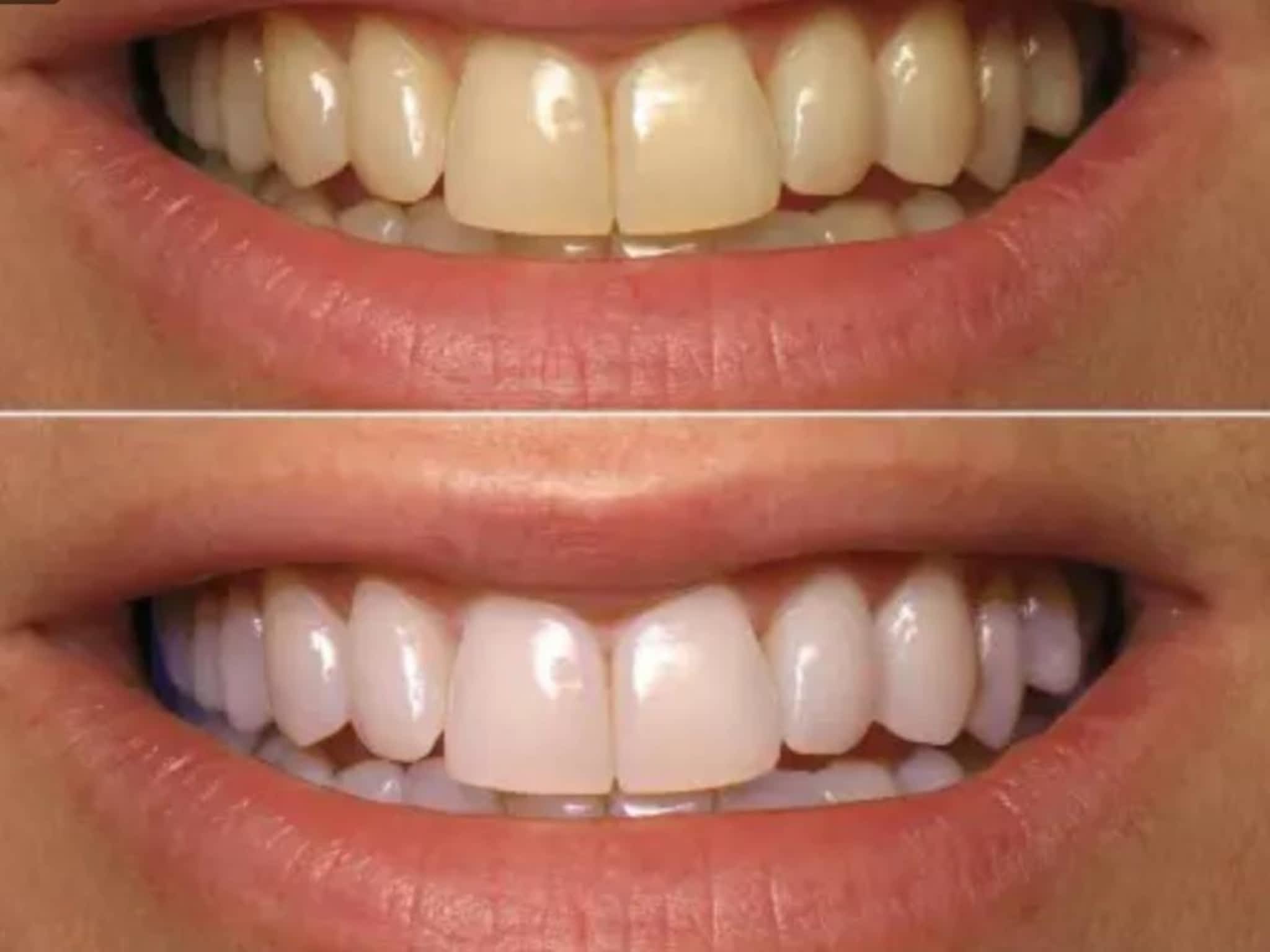 photo Gergana's Beauty & Teeth Whitening