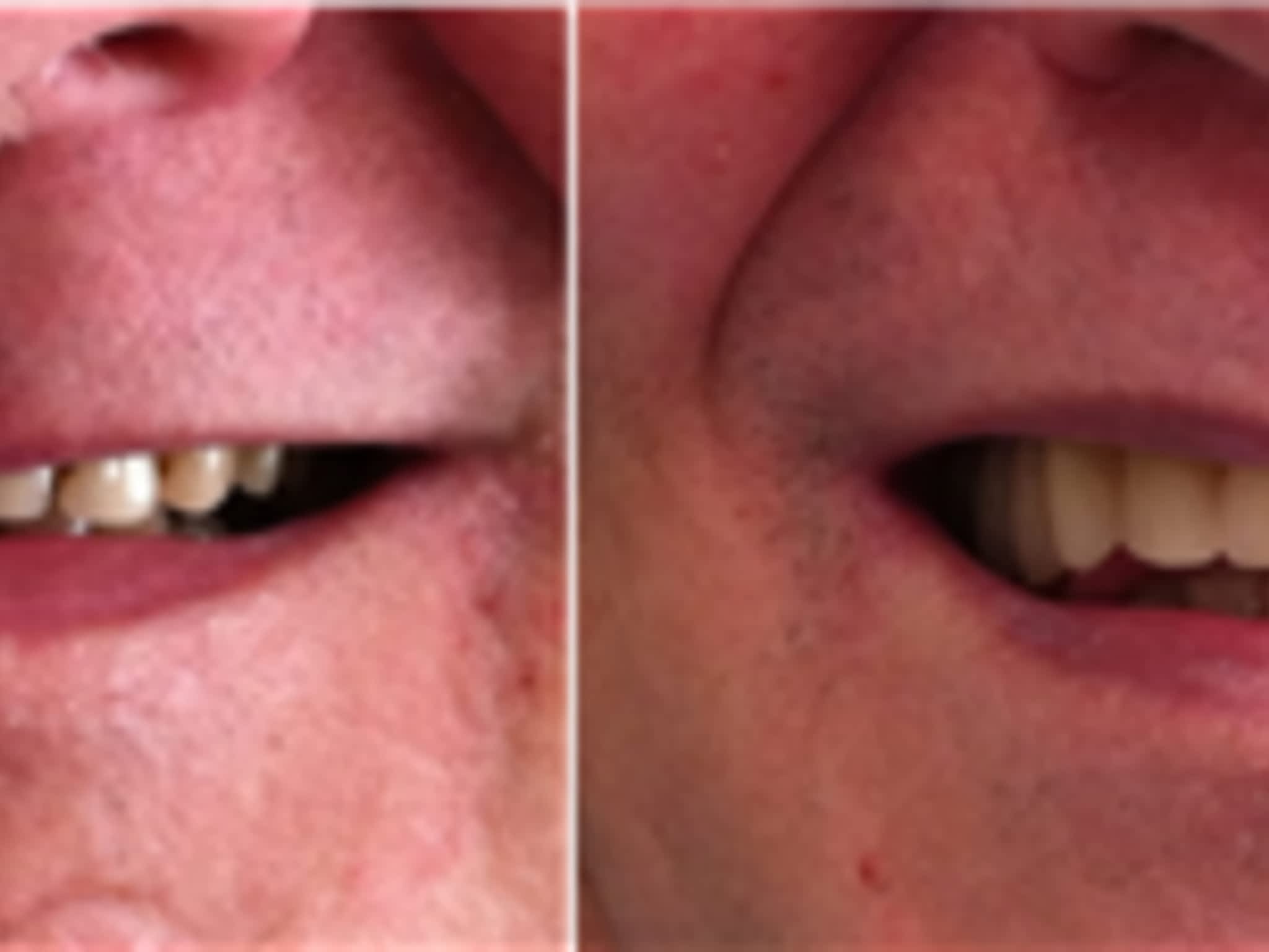 photo Quinte Denture Clinic