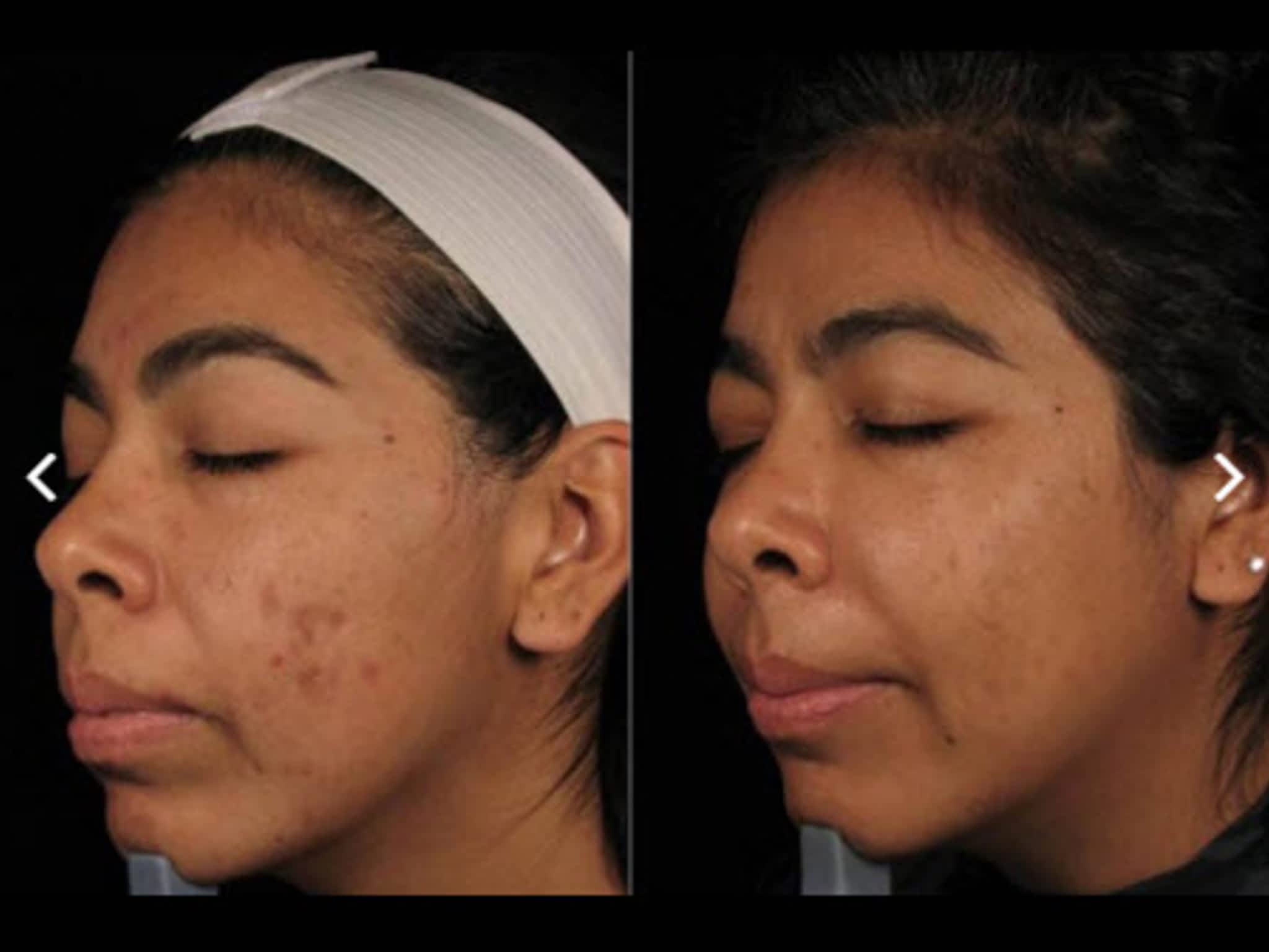 photo Rejuvenation Makeup and Laser Clinic