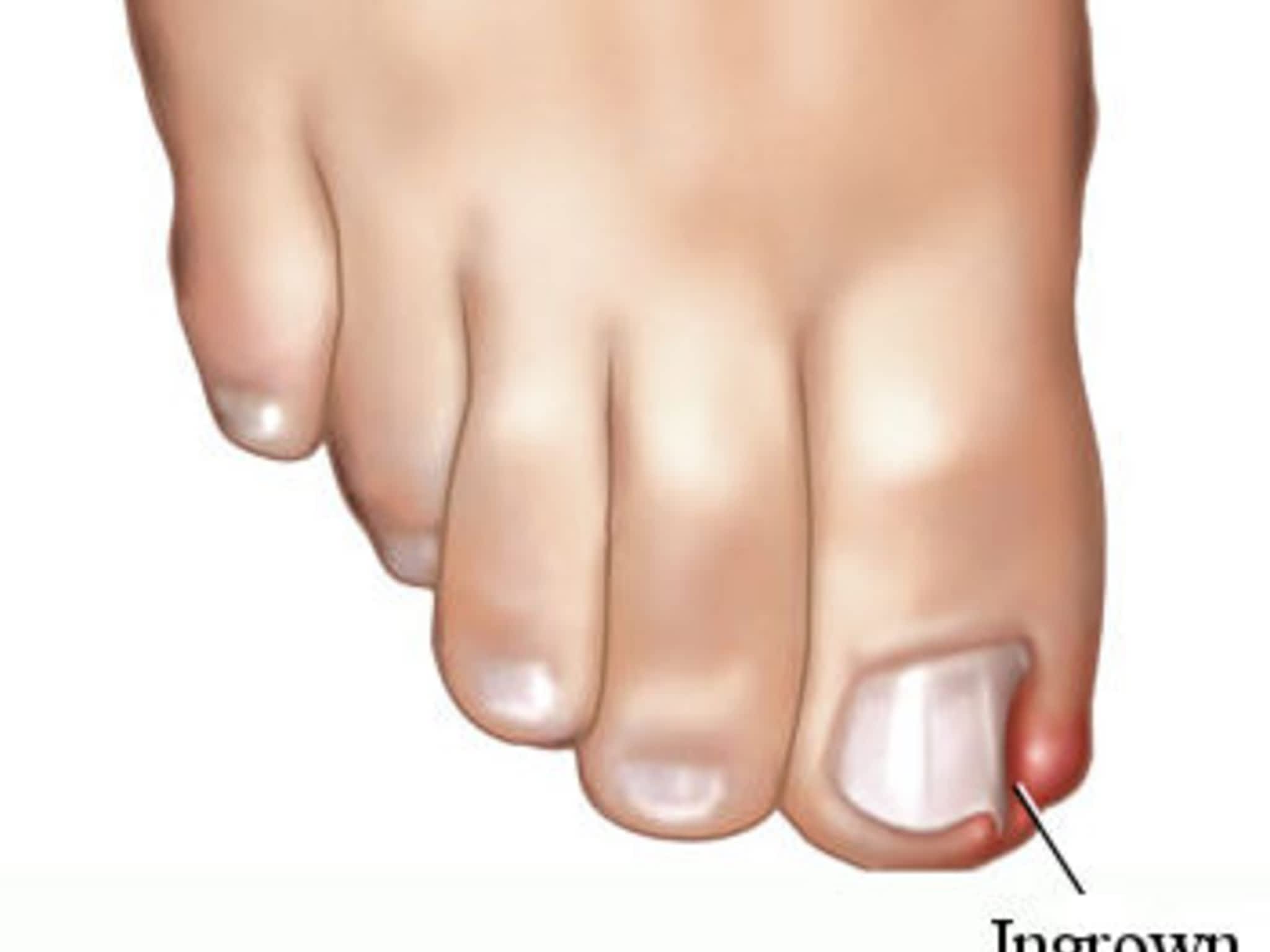 photo Rite Step Orthotics